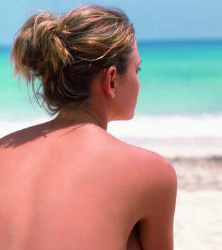 Какво да правим при слънчево изгаряне?