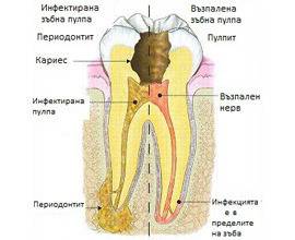 Пулпит – Стоматологичен център, Зъболекарски услуги – IG Dental