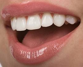 Металокерамика – Стоматологичен център, Зъболекарски услуги – IG Dental