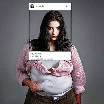 Бариатрична хирургия е раздел, занимаващ се конкретно с лечението на хора с наднормено тегло