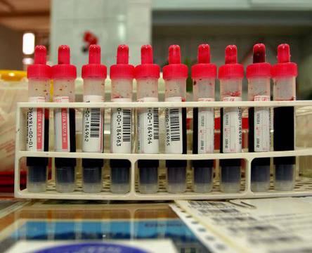 Имуноглобулини Е сочат алергии и инфекция с паразити