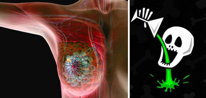 Гъбичките кандида водят до развитието на рак