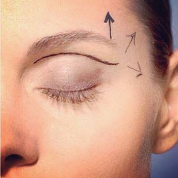 Пластика на клепачи – Една от най-популярните оперативни интервенции в пластичната хирургия