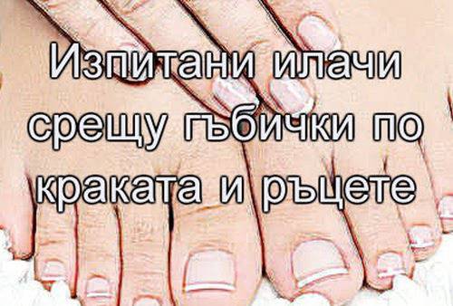 Билки и бабини рецепти: Изпитани илачи срещу гъбички по краката и ръцете