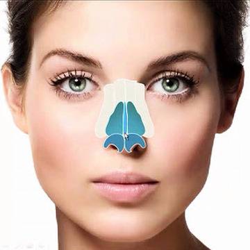 Ринопластика – Скулптуриране и Оформяне на носните кости и хрущяли