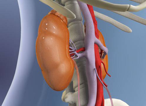 Гломерулонефрит е възпаление на бъбреците, причините са различни