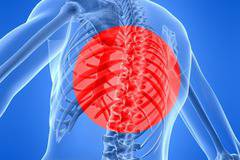 Дископатията поваля хора със слаби мускули