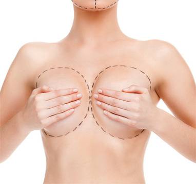 Уголеменият бюст, чрез поставяне на силиконови импланти, не пречи на бъдеща бременност и кърмене