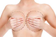 Уголеменият бюст, чрез поставяне на силиконови импланти, не пречи на бъдеща бременност и кърмене