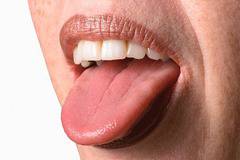 Какво казва за здравето жълтият, кафяв или космат език