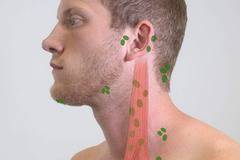 Какви са причините за подути лимфни възли?