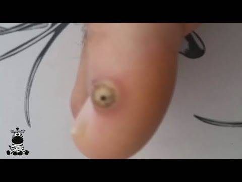 Ще ви побият тръпки, след като видите как се маха кокоши трън! (видео)