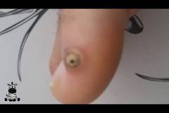 Ще ви побият тръпки, след като видите как се маха кокоши трън! (видео)