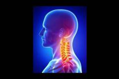 С едно ЕДИНСТВЕНО упражнение ще забравите за болката в гръбначния стълб! ИЗПИТАНО! (видео)