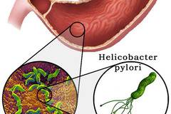Терапия срещу Хеликобактер Пилори при основно заболяване Склеродермия