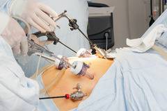 Лапароскопска хирургия е ново модерно отделение в болница Медлайн Пловдив