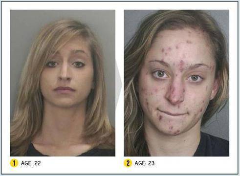 Вижте историята на това младо момиче за пристрастяването към дрогата и последствията от метамфетамина