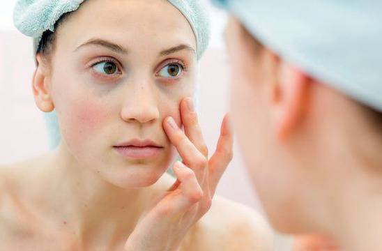 Как да се справим с тъмните кръгове под очите?