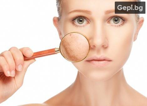 Лечение на пигментация на лицето с PTF фототерапия.