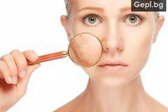 Лечение на пигментация на лицето с PTF фототерапия.