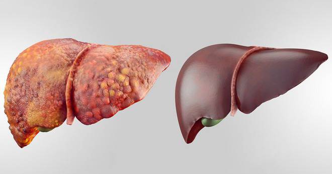 Древна рецепта от Русия чисти черния дроб и жлъчката!