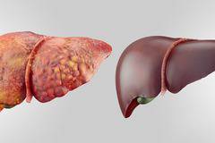 Древна рецепта от Русия чисти черния дроб и жлъчката!