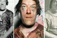 Вижте разтърсващата история на „най-грозната жена в света“!