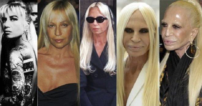 Вижте как изглеждаше Донатела Версаче преди 25 години, когато още беше естествено красива (снимки)