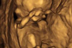 Бременност – видове проследяване