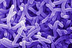 Прокариотна клетка (бактерии)