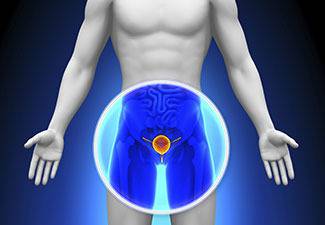 Диагностика и лечение на Доброкачествена хиперплазия на простатната жлеза (уголемена простата)
