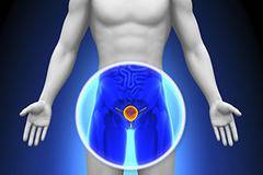 Диагностика и лечение на Доброкачествена хиперплазия на простатната жлеза (уголемена простата)