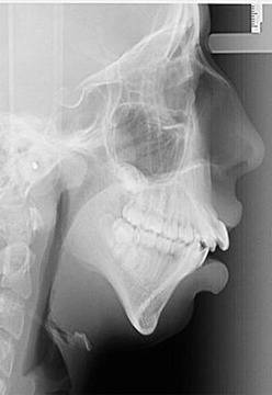 Всички я наричаха „изрод“, „крокодил“ и какво ли още не, но те не знаят, че днес тя е ТОПМОДЕЛ! Вижте я сега