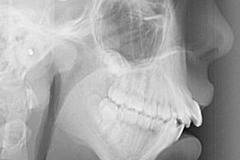 Всички я наричаха „изрод“, „крокодил“ и какво ли още не, но те не знаят, че днес тя е ТОПМОДЕЛ! Вижте я сега