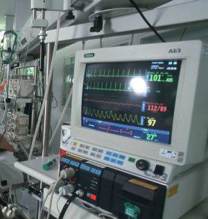 Причини и симптоми на сърдечните аритмии