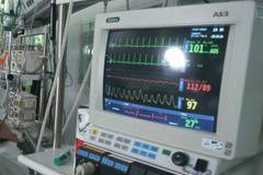 Причини и симптоми на сърдечните аритмии