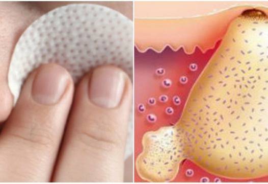 Помните ли „Вишневската маз“? Вижте за колко много неща помага!