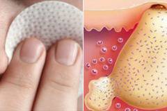 Помните ли „Вишневската маз“? Вижте за колко много неща помага!