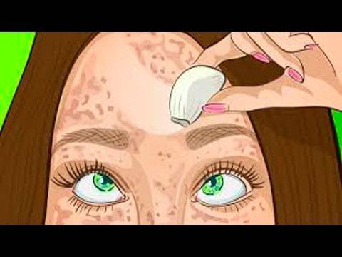 Бабините рецепти винаги помагат! Край на черните точки и пигментните петна с тези съвети, извадени от скриновете!