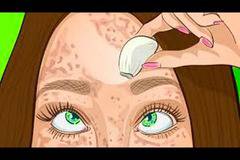 Бабините рецепти винаги помагат! Край на черните точки и пигментните петна с тези съвети, извадени от скриновете!