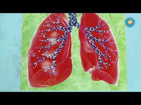 Екстремна рецепта за болно гърло и кашлица лекува за денонощие!