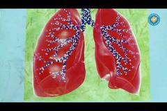 Екстремна рецепта за болно гърло и кашлица лекува за денонощие!