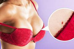 Какво означават тези червени точки по кожата?