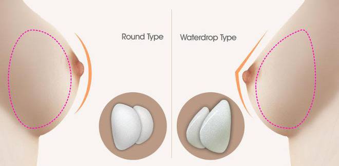 Кръгли или Анатомични силиконови импланти