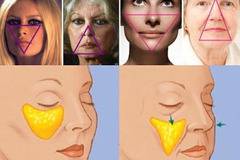 Кое е „Триъгълник на Младостта“ (Triangle of Youth)