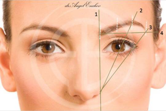 Брау Лифт – Лифтинг на вежди