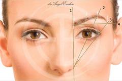 Брау Лифт – Лифтинг на вежди