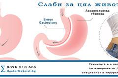 Sleeve gastrectomy е лапароскопска техника, успешно прилагана от Д-р Габриел, специалист в хирургия на наднормено тегло