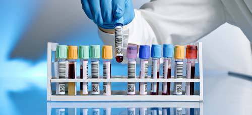 Кога се изследва гликиран хемоглобин и какво показват стойностите