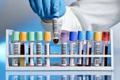 Кога се изследва гликиран хемоглобин и какво показват стойностите